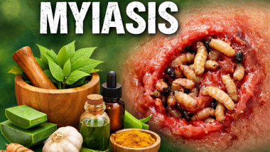 Herbal Remedies for Myiasis