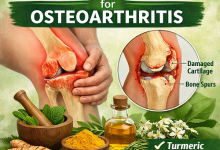 Herbal Remedies for Osteoarthritis