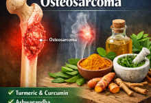 Herbal Remedies for Osteosarcoma