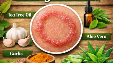 Herbal Remedies for Ringworm