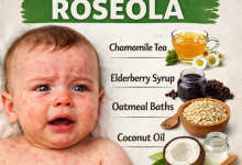 Herbal Remedies for Roseola