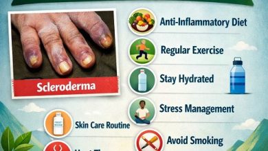7 Natural Ways to Manage Scleroderma Symptoms