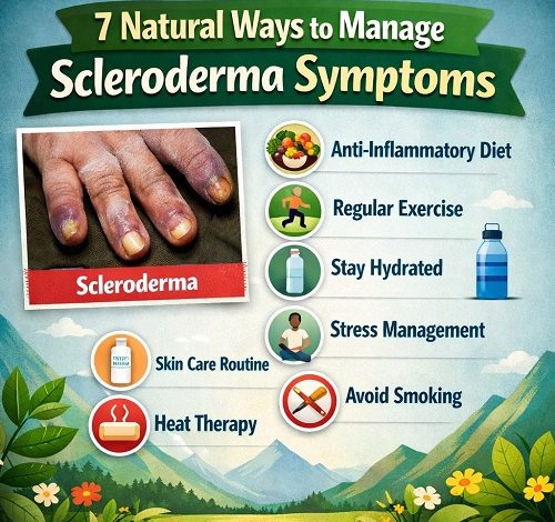 7 Natural Ways to Manage Scleroderma Symptoms