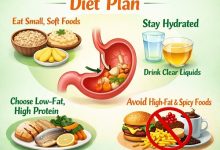 Gastroparesis Diet Plan