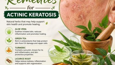 Herbal Remedies for Actinic Keratosis