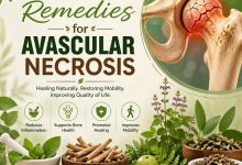 Herbal Remedies for Avascular Necrosis
