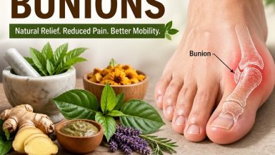 Herbal Remedies for Bunions