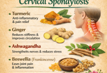 Herbal Remedies for Cervical Spondylosis