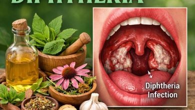 Herbal Remedies for Diphtheria