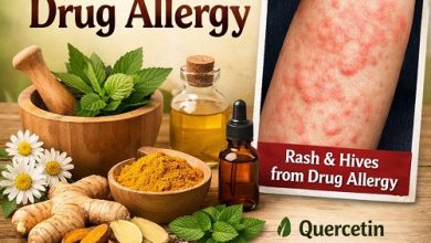Herbal Remedies for Drug Allergy