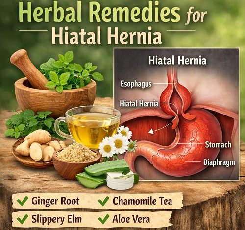 Herbal Remedies for Hiatal Hernia