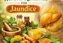 Herbal Remedies for Jaundice