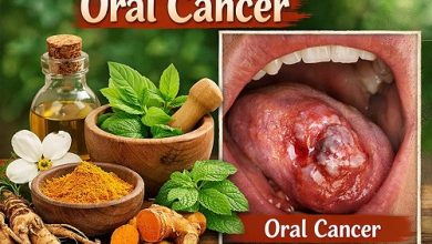 Herbal Remedies for Oral Cancer