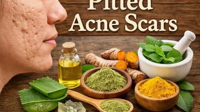 Herbal Remedies for Pitted Acne Scars