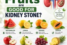 Which Fruits Are Good for Kidney Stones