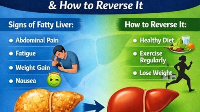 what are the signs of fatty liver and how to reverse it