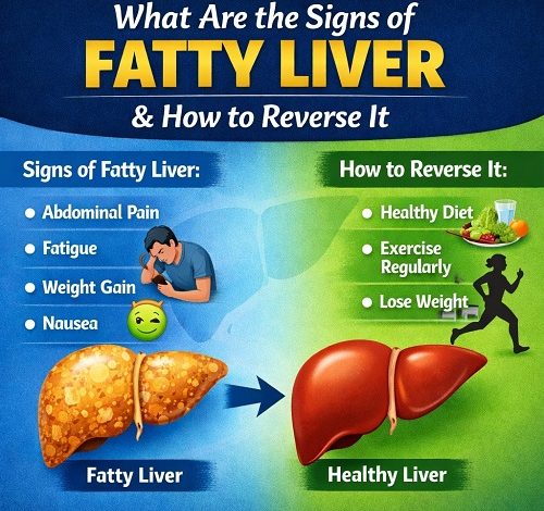 what are the signs of fatty liver and how to reverse it