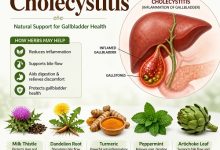 Herbal Remedies for Cholecystitis