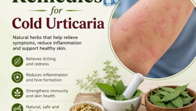 Herbal Remedies for Cold Urticaria