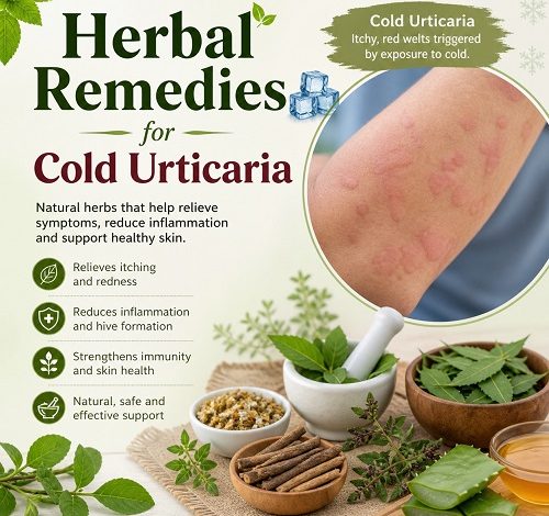 Herbal Remedies for Cold Urticaria