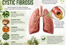Herbal Remedies for Cystic Fibrosis