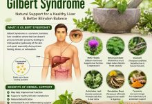 Herbal Remedies for Gilbert Syndrome
