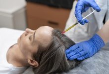 prp-for-hair-restoration-gallery.jpg