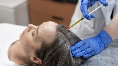 prp-for-hair-restoration-gallery.jpg