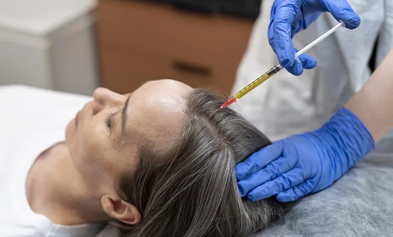 prp-for-hair-restoration-gallery.jpg